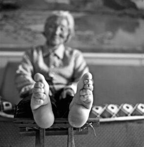 زنی سالخورده با پاهای باندپیچی شده از دوره کودکی